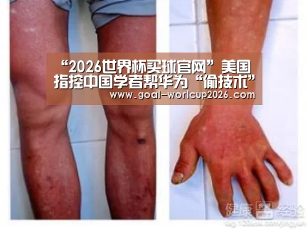 2026世界杯买球官网